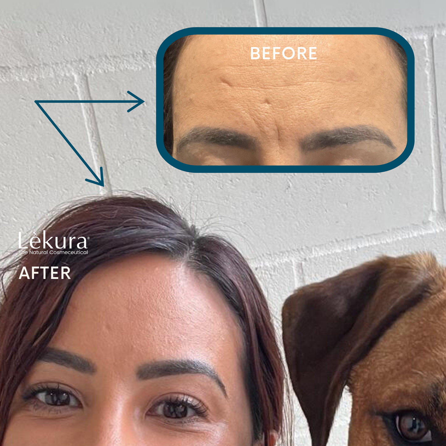 Contour Cups + Contour Face Oil + Free Antibacterial Spray